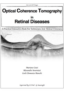 Optical Coherence Tomography in Retinal Diseases